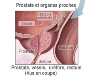 schema prostate homme