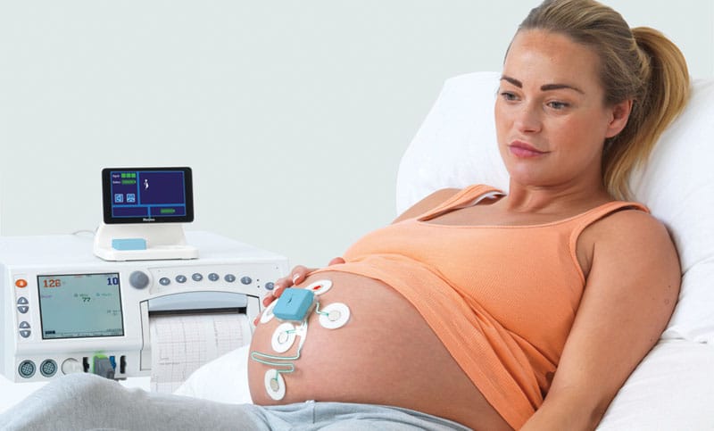 https://www.avf-biomedical.com/app/uploads/2021/04/choisir-son-materiel-de-monitorage-foetal.jpg