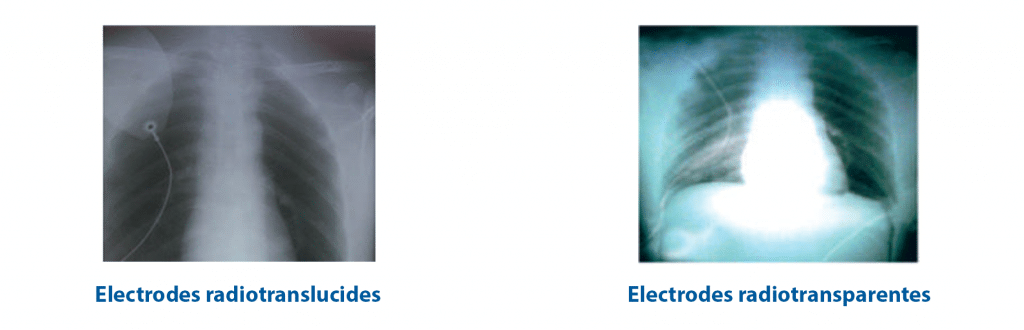 Electrodes radiotranslucides et radiotransparentes
