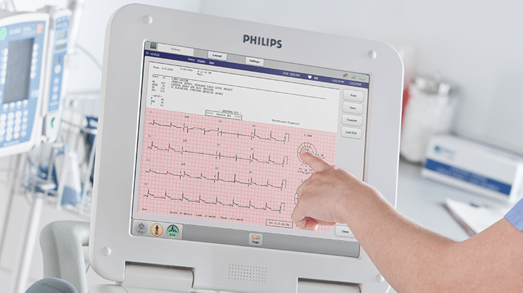 Tracé ECG d'un patient