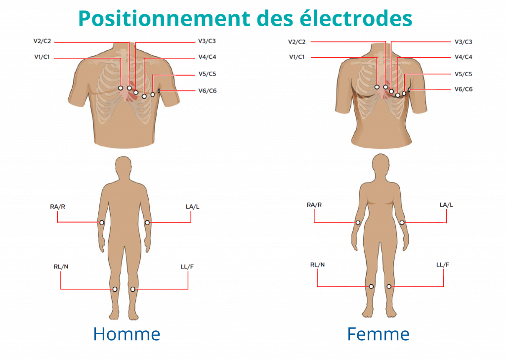 Découvrez les meilleurs électrodes médicales