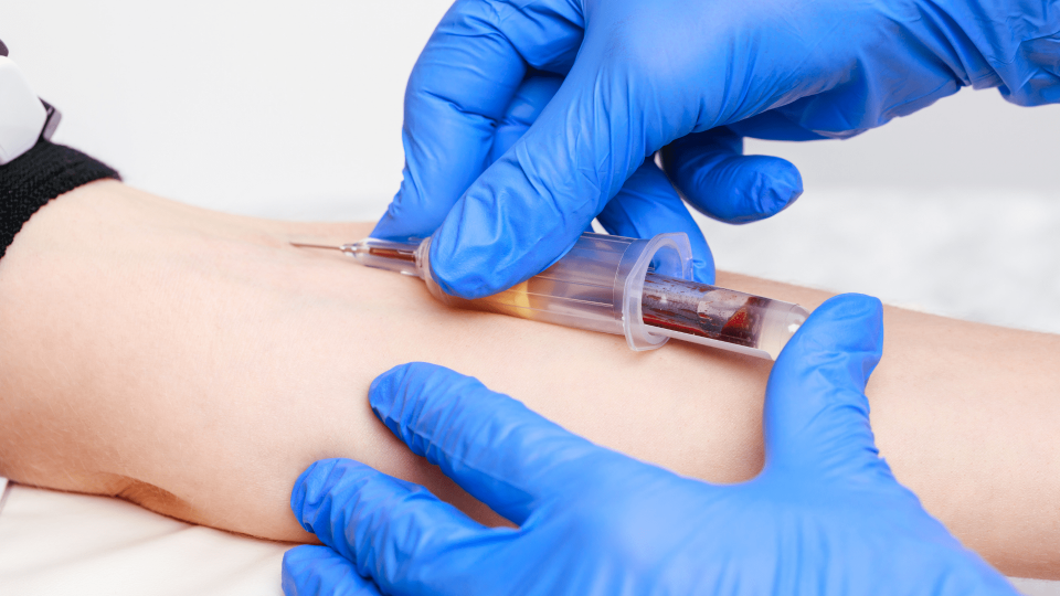 Tout Savoir Sur le Prélèvement Veineux AVF Biomedical