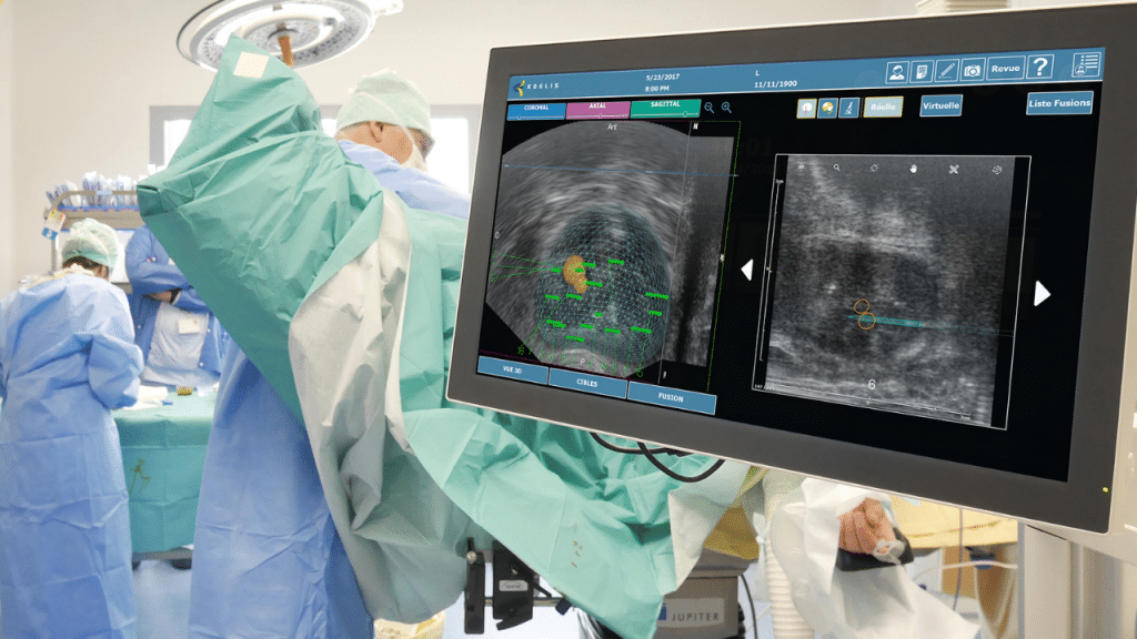 Urologue réalisant une biopsie de prostate