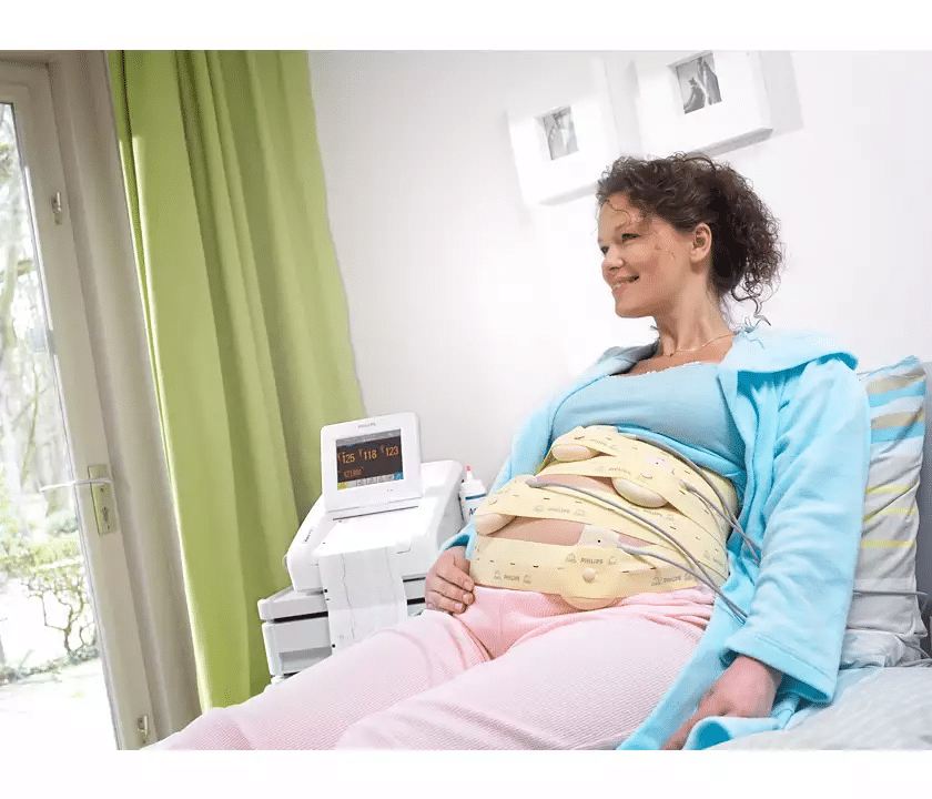 Moniteur fœtal Philips FM30 installé sur chariot, avec capteurs connectés pour la surveillance maternelle et fœtale en salle d’accouchement.